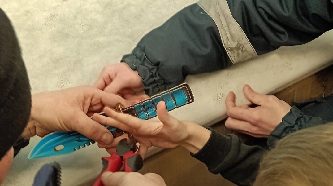 В Прикамье пришлось вызывать спасателей, чтобы достать палец ребенка из игрушки