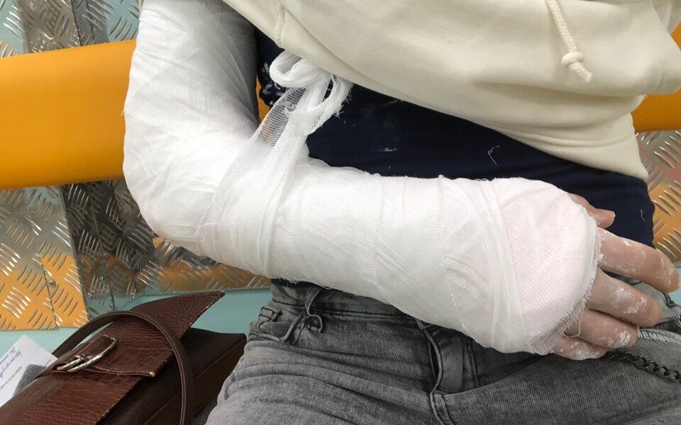 Пермячка сломала руку на ступеньках городской больницы