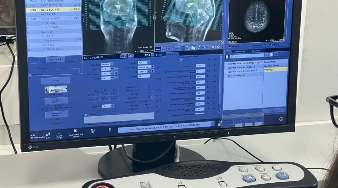 К лечению пострадавших в ДТП в Кунгурском округе подключились врачи федеральных центров