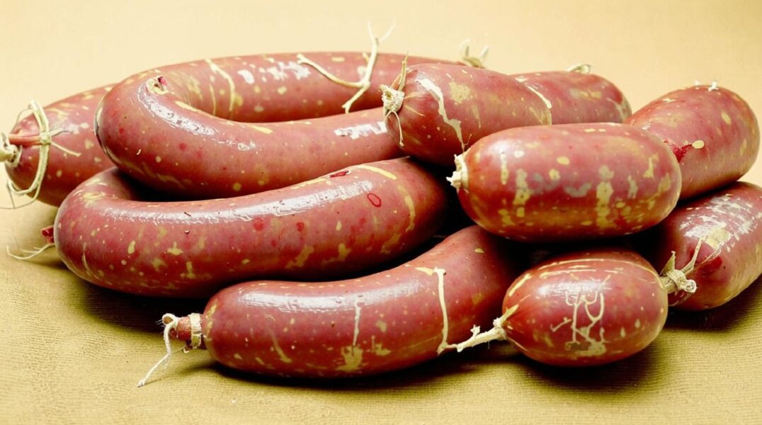 Сотрудники батутного центра в Кунгуре предложили сосиски девушке с переломом позвоночника