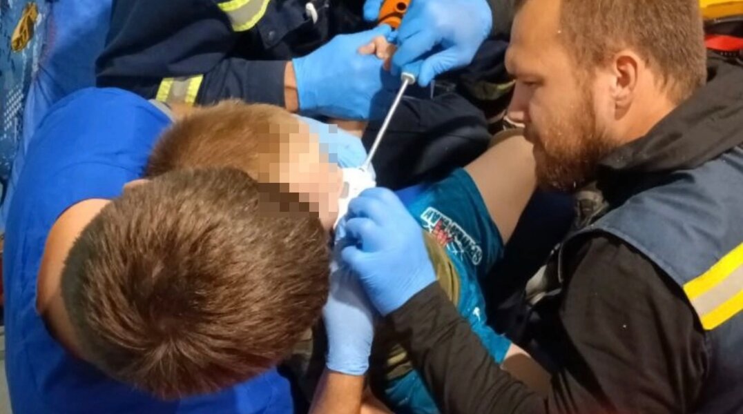 В Перми ребенок получил травму языка при контакте с электроприбором