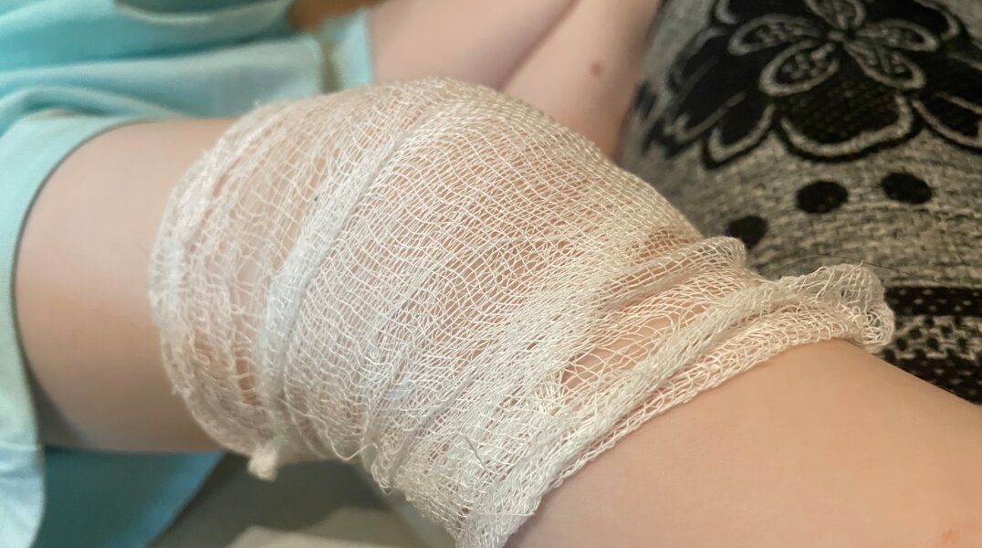 Детский сад выплатит компенсацию после падения шкафчика на ребенка