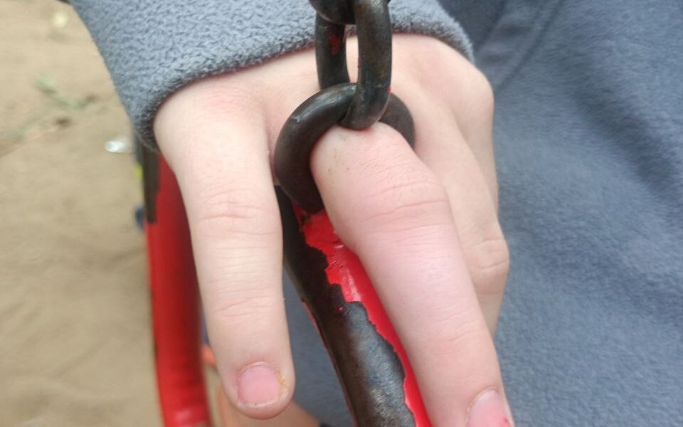 В Перми у ребенка застрял палец в цепочке детской качели во дворе