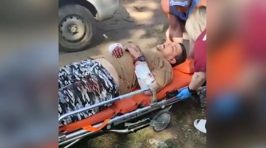 Пермского зоозащитника серьезно покусала собака