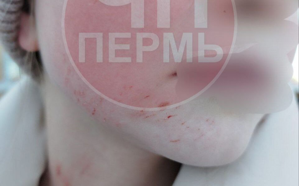 В Перми подростки закидали льдом хоббихорсера — полиция проводит проверку