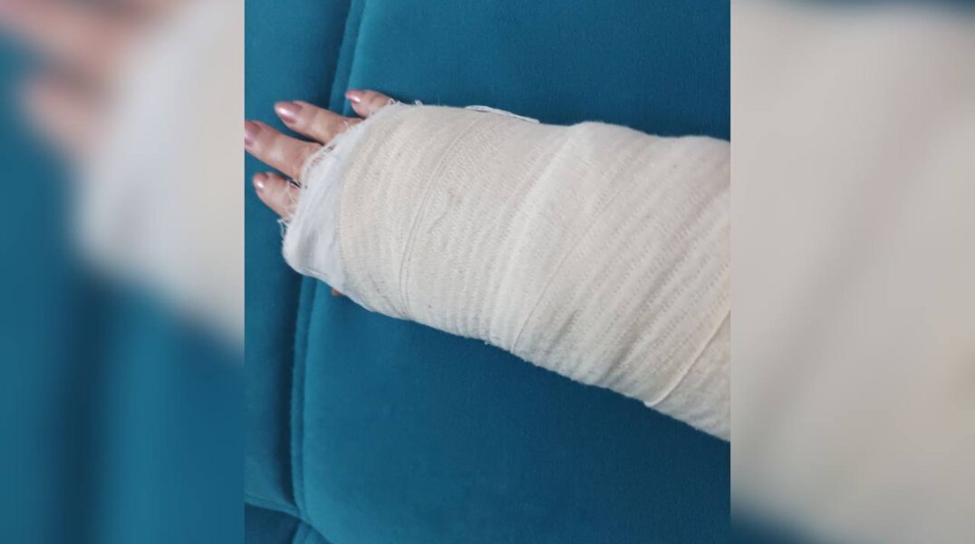 В Перми за месяц более 140 человек пострадали при падении на гололеде