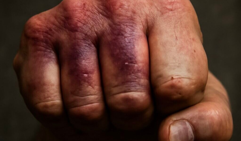 Житель Добрянки выплатил компенсацию за избиение при трудоустройстве