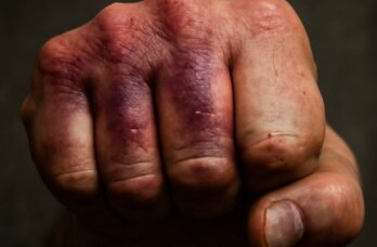 Житель Добрянки выплатил компенсацию за избиение при трудоустройстве