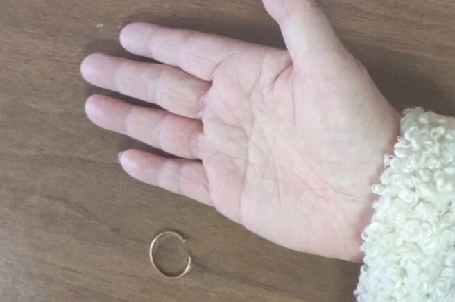 Пермячке пришлось вызывать спасателей, чтобы снять кольцо