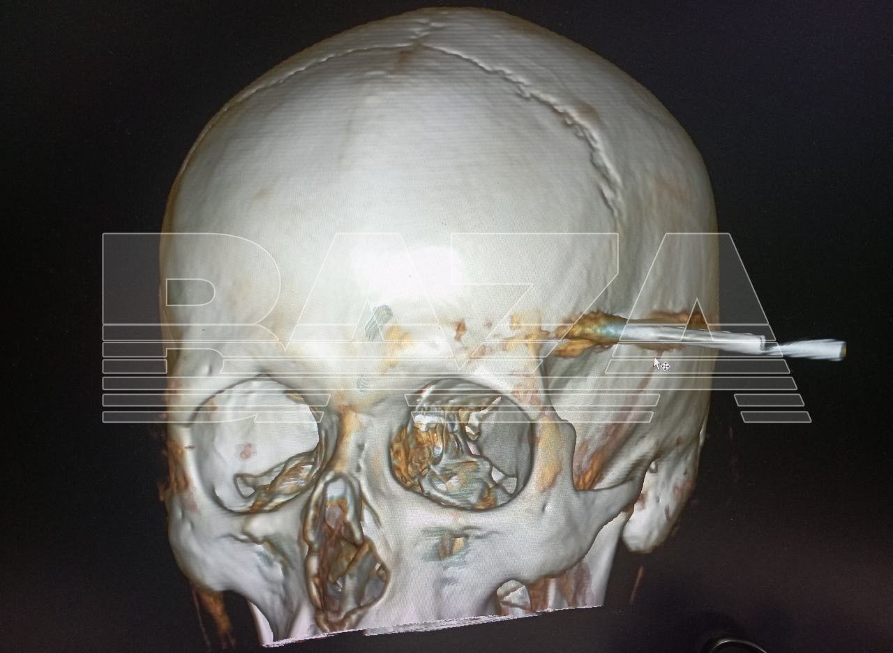 Telegram-канал Baza