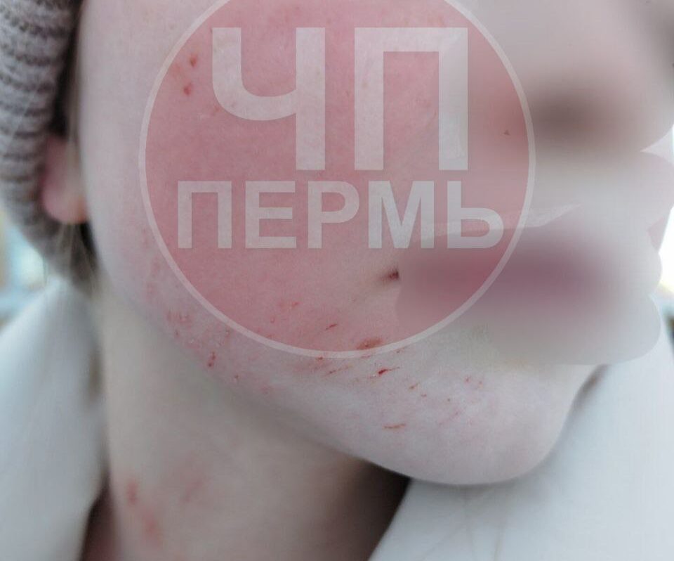 Фото: ЧП Пермь / ТГ